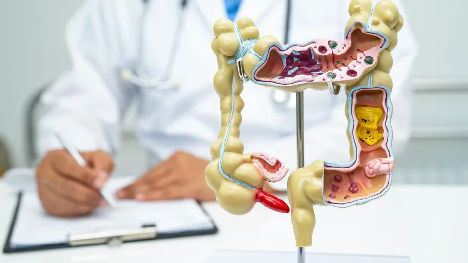 Alimento reduz em 20% o risco de câncer de intestino, revela novo estudo