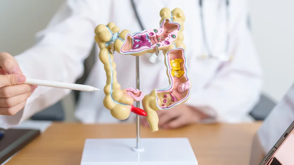 Câncer colorretal é mais agressivo entre os jovens, diz estudo brasileiro