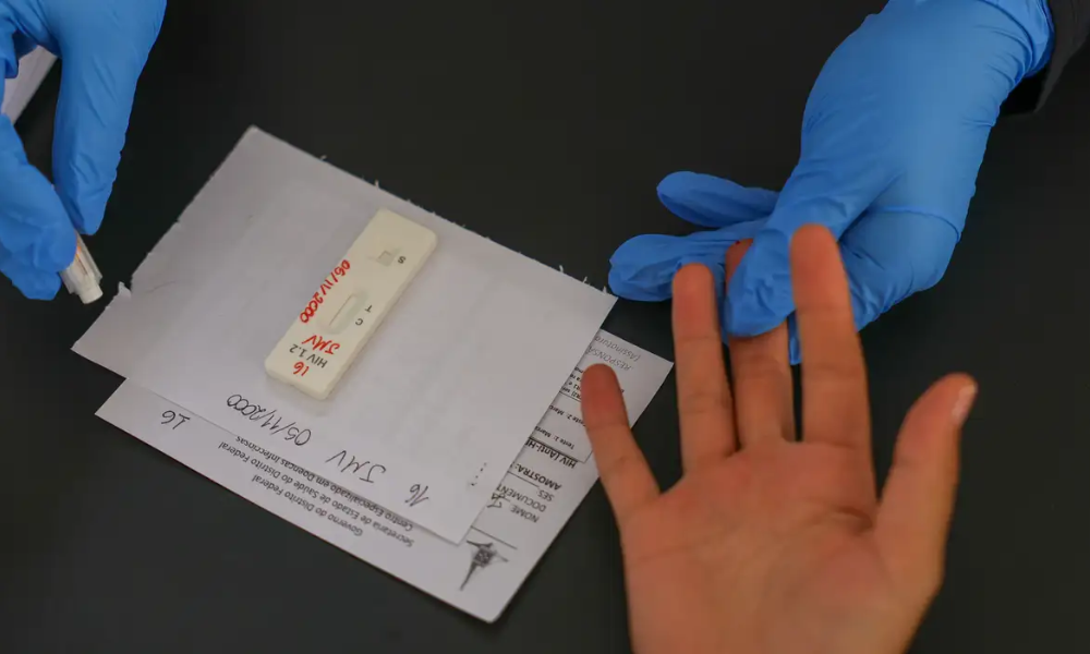 HIV/Aids: Brasil insistirá em acordo por PrEP de longa duração