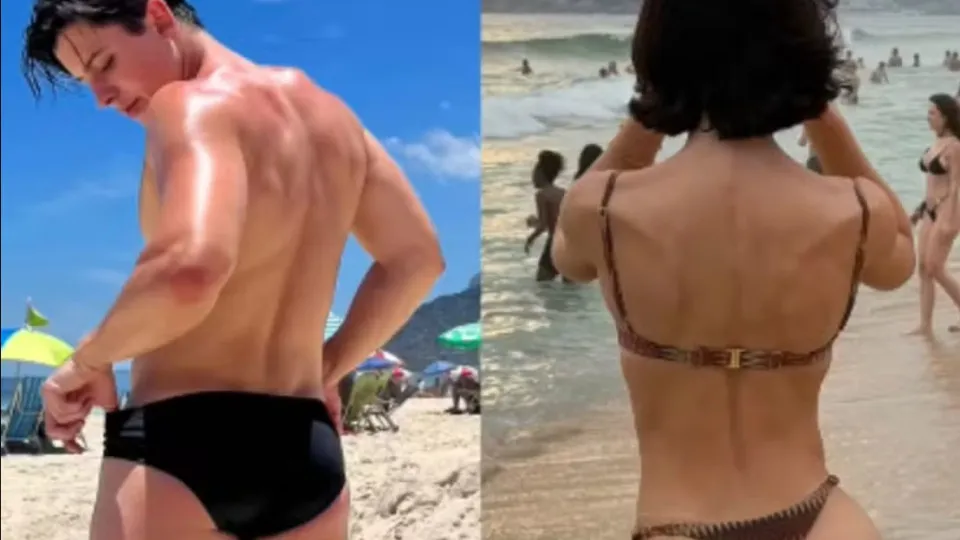 Bella Longuinho mostra antes e depois de procedimento nos glúteos; veja