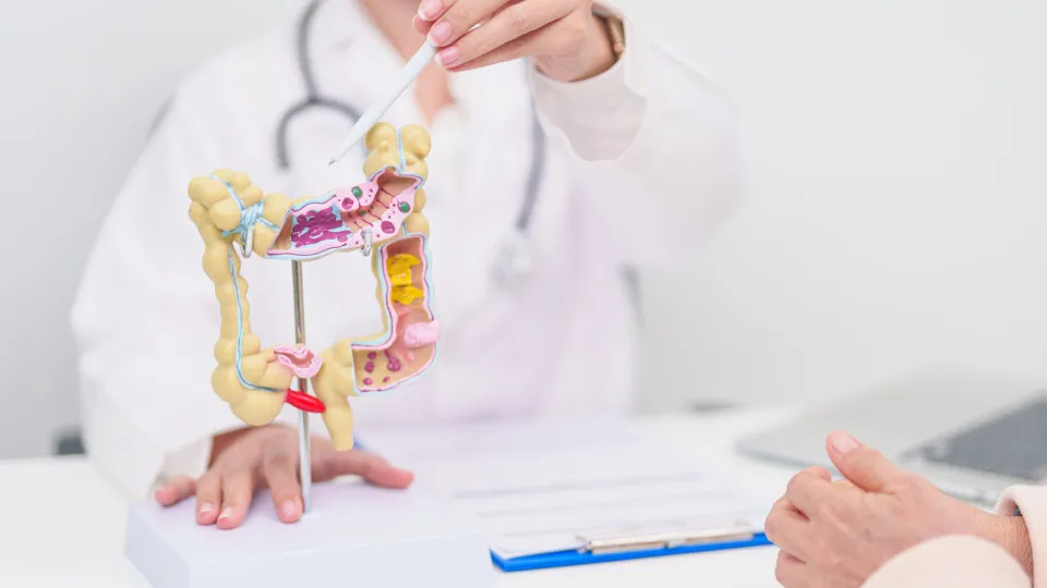 Hábitos diários que podem ajudar a reduzir o risco de câncer colorretal